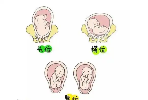 女人喝羊奶粉的功效与作用孕妇喝羊奶粉的六大好处