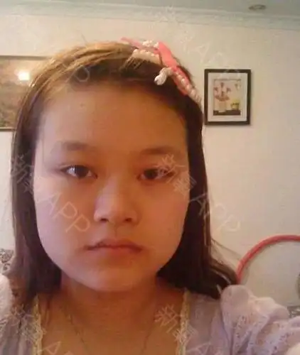 我们常常用大饼脸来形容一个人的脸型不好看,很多人觉_圈子-新氧美容