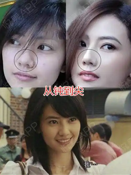 国民女神高圆圆真的是天然脸吗