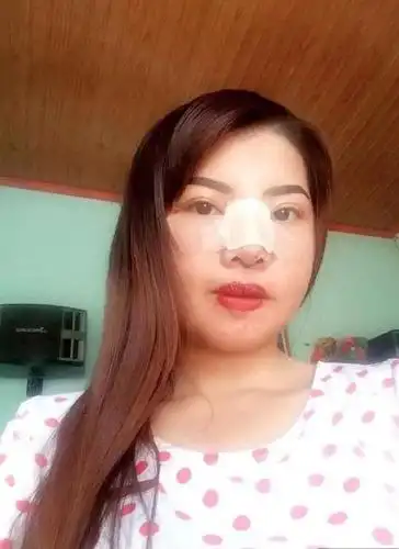 她因太丑嫁不出去还被前夫抛弃,斥巨资整容后竟意外嫁入豪门