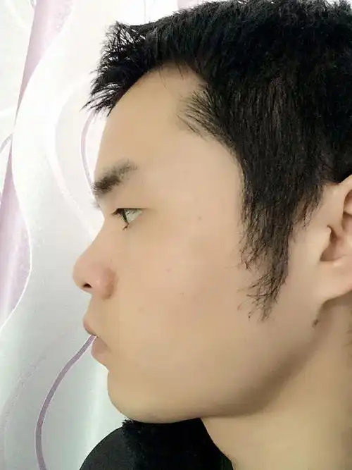 请问这是不是鼻梁低?