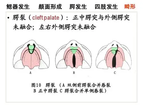 颜面和四肢的发生ppt