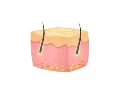 如何修护受损的皮脂膜?