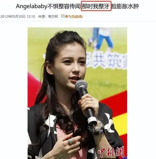 长得"歪瓜裂枣",整得"美若天仙",有些女星都靠脸逆天改命