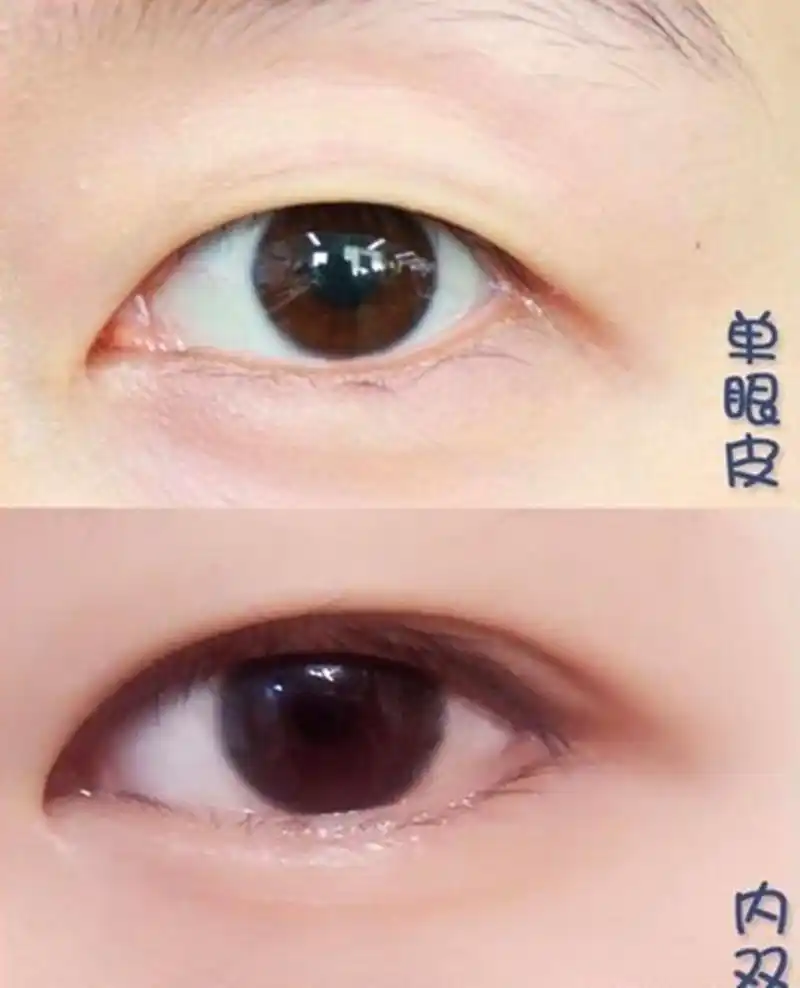 怎么区分单眼皮和内双?
