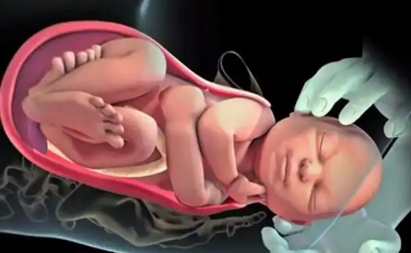 胎儿是怎么从那小的口出来的详细了解全过程看完服了