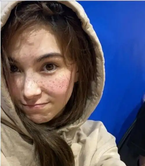 哪些女明星脸上雀斑多,舒淇嘴大雀斑多到底算不算大美女