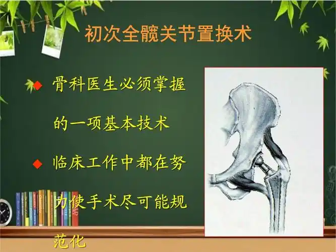 初次全髋关节置换实用技术-课件.ppt