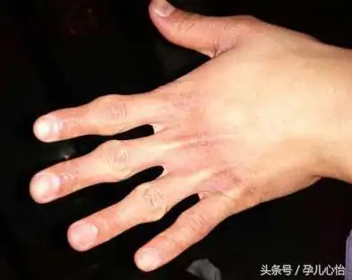 苦命人的手相手纹乱如麻注定劳累一生