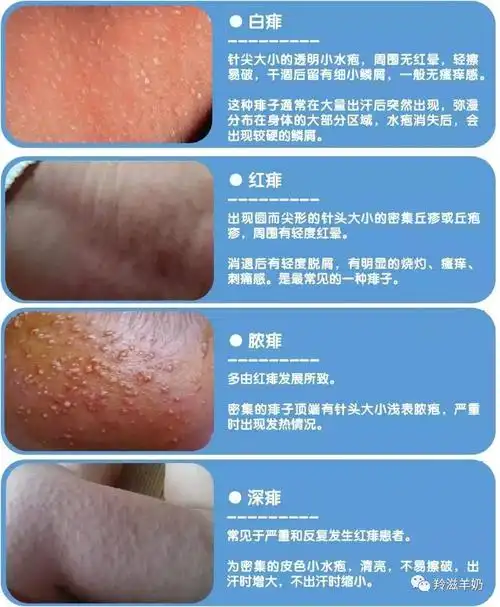 小心越护理越严重! - 羊奶粉|羚滋羊奶|羚滋羊奶粉官方网站