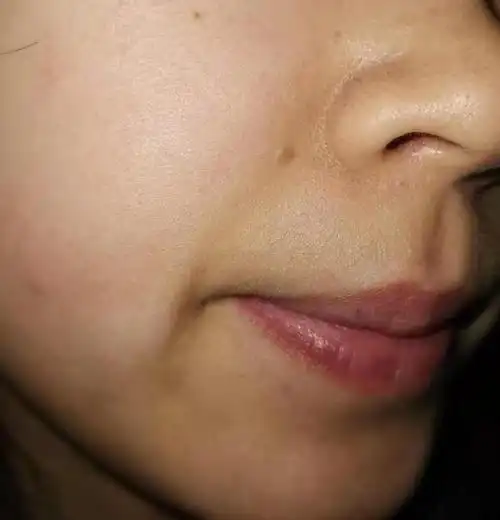 肤色暗沉发黄是为啥祛黄水乳推荐提亮肤色美白去黄一步到位