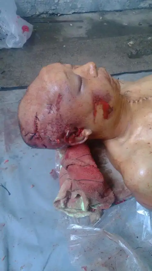 处遭到一伙不明身份人员殴打,颅脑严重损伤,脑浆迸裂,于00:30分抢救