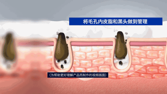 不要草莓鼻,用这个"毛孔吸尘器",黑头粉刺全吸走!