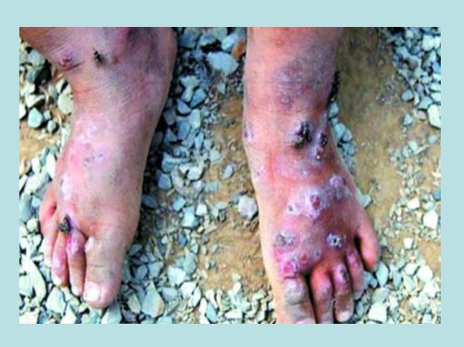 冀教版七年级下册第二单元第六章第三节艾滋病的发生与流行课件24张