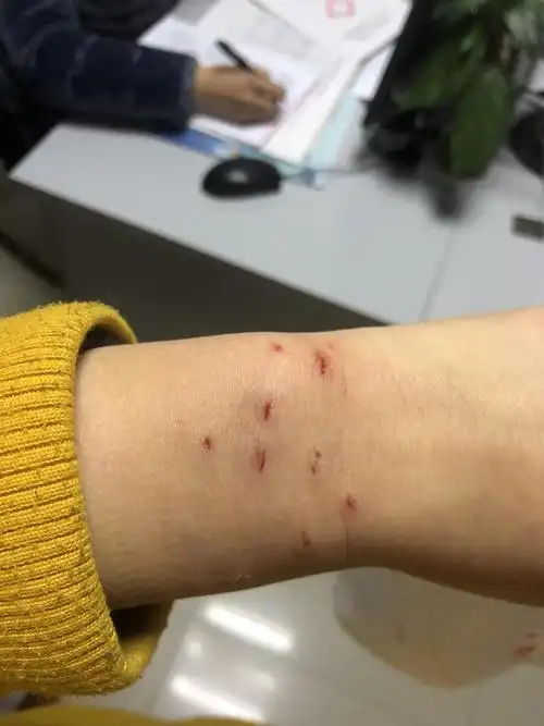 猫咪突然咬我怎么办