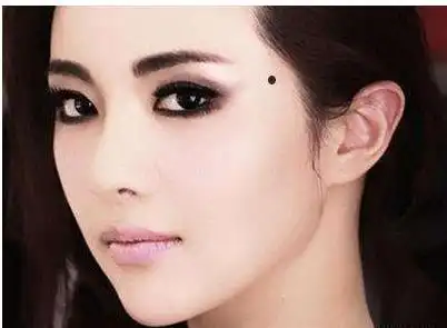 算命的说身上有这4颗痣有望大发横财一夜致富