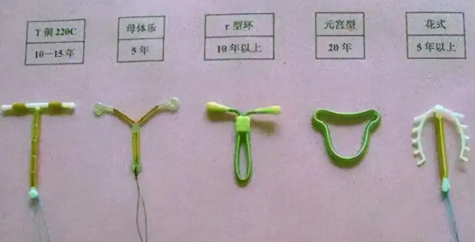 您知道吗?不管哪种节育环都有保质期的!