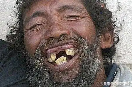 盘点全球最丑的男人