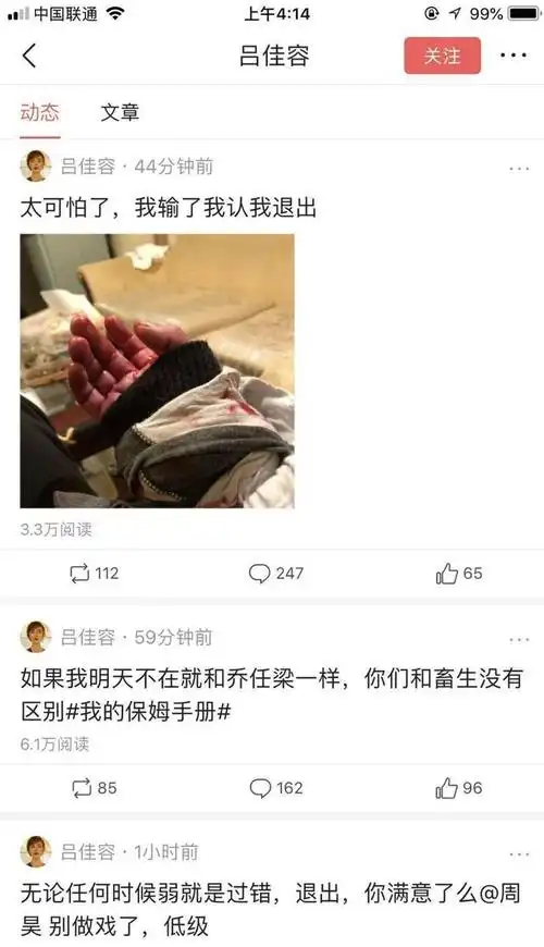 吕佳容发割腕照吓坏网友吕佳容要自杀吗原因是什么