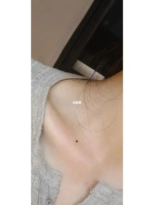 竟然是心78型的锁骨痣好神奇