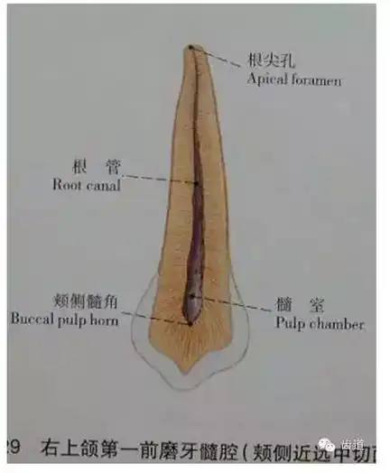 送给准备及刚当牙医的您牙体解剖生理之牙髓腔各部名称及形态三