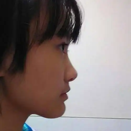 侧脸看起来这样要怎样改善才会看起来好看点?