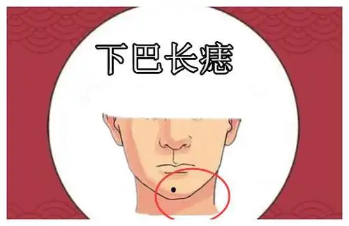 5颗发财痣颗颗带黄金男人升官快一步女人发财不用愁