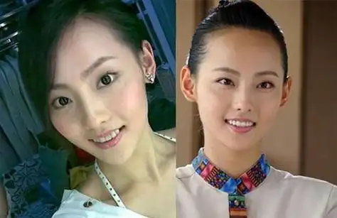 张嘉倪整容,张嘉倪出道前的照片,本文共(2627字)