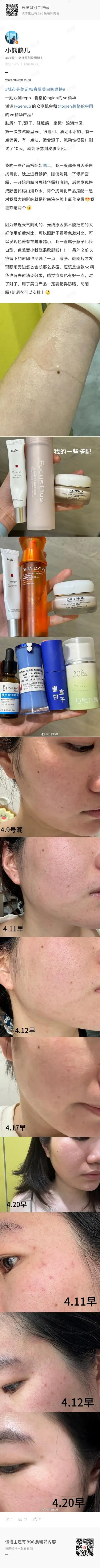 城市寻美记##春夏精简护肤##美白