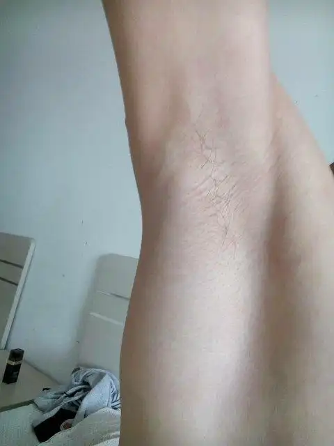 男腋毛长这么些,还能长个吗,你们多大腋毛是长这么些的?