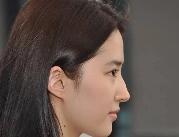 波浪鼻是驼峰鼻吗