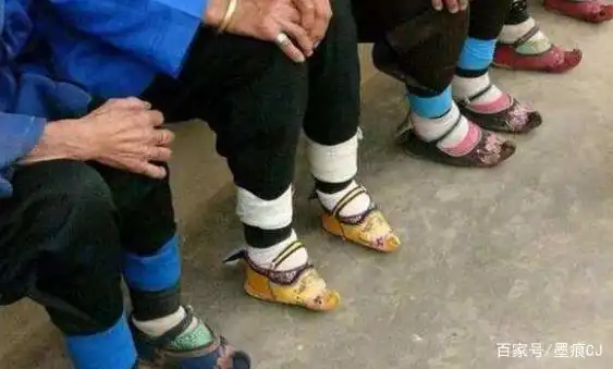 现在的流行我不懂,切小腿,当代"裹小脚"还要毁掉多少女孩?