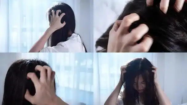 头皮抓破,头发抓脱落……止痒,很简单!