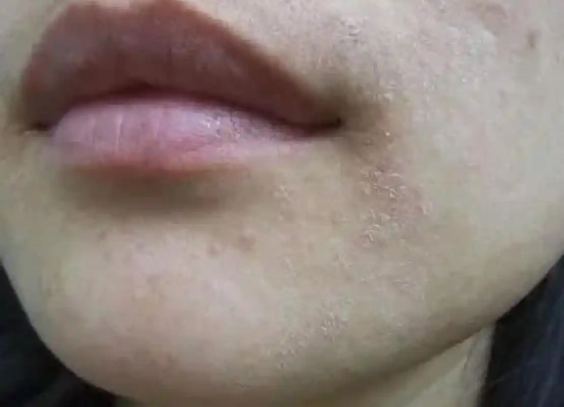 春夏换季皮肤干燥敏感还发痒怎么办?