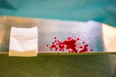 银色医院桌上的白色压缩和红色滴血照片