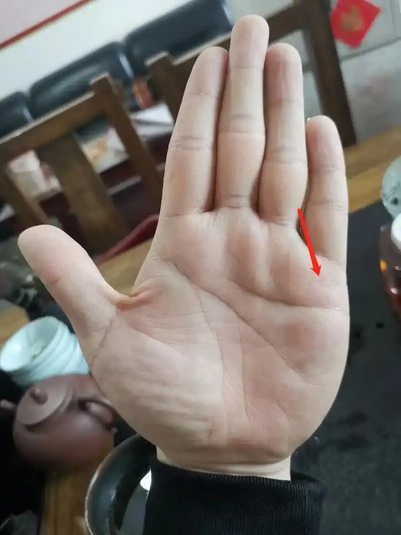这手纹手相生命线中途出现断裂,上部出现鸟鸟纹主血光
