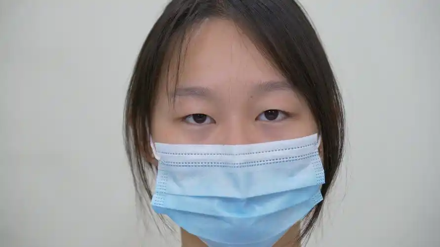 在了解大量双眼皮手术照片案例后,她决定尝试.术前,她的眼睛稍显无神.