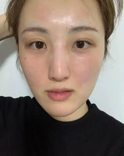 脸上有这五个"信号",说明皮肤严重缺水!中2个以上皮肤就很差