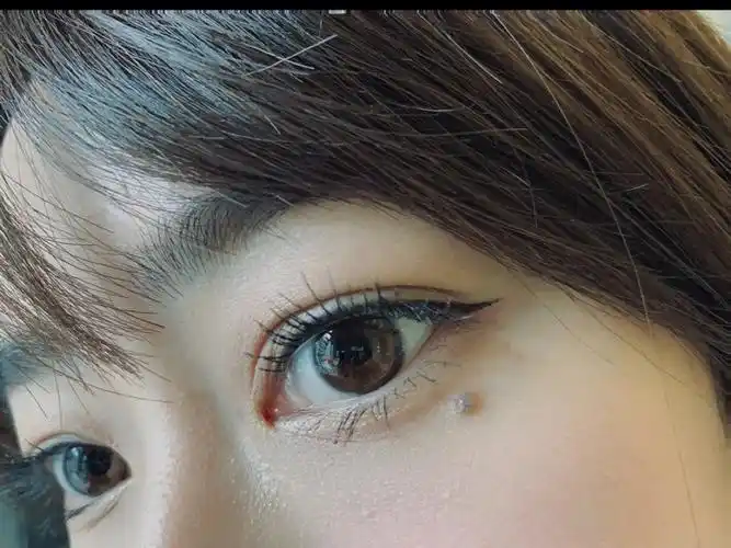 看到现在很多小姐姐化妆都喜欢点一颗泪痣平时也有人说我的泪痣很