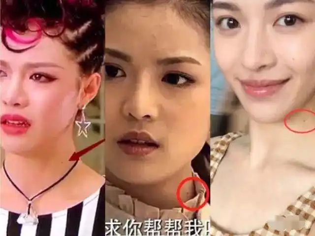 钟楚曦也被质疑"整容"了,当初说好的纯天然高级脸人设要崩吗