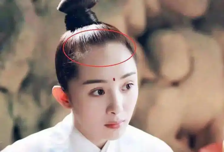 杨颖近照发际线后移严重,比杨幂还高!