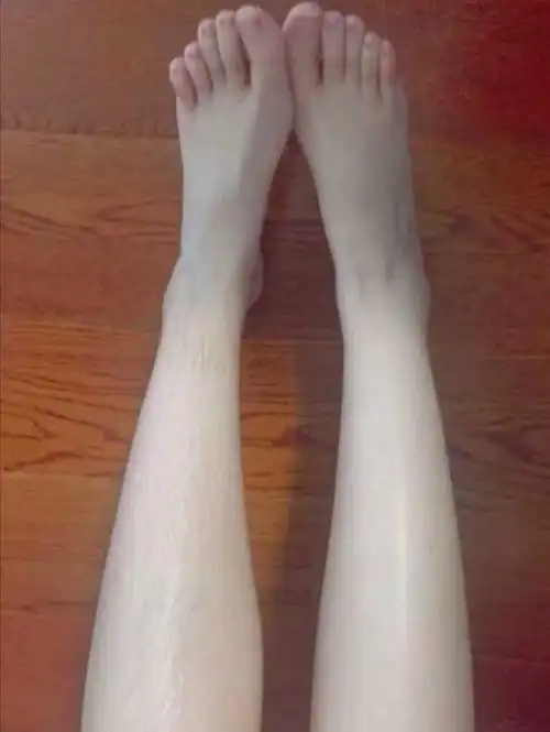 腿毛长的女生一定要脱毛吗?