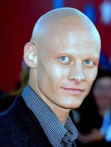 32款男士秃顶发型!