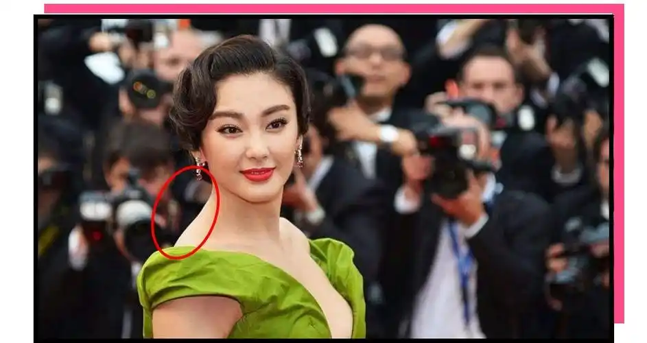 长期以往,脖子前倾和驼背就会找上你!