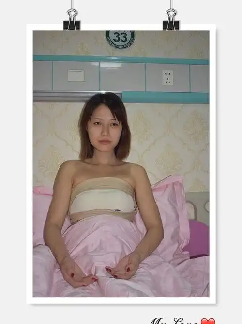 看我的术前照就能看出来我的胸部真的蛮平的,只有a罩杯,除了胸部基础