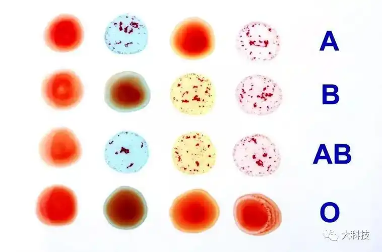 血型决定了性格