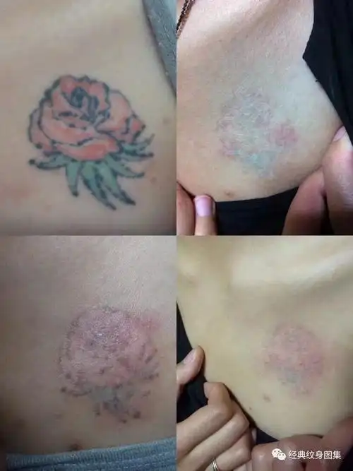 洗纹身必看很重要的注意事项