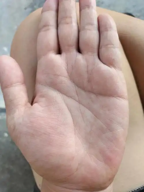 我已经有了超级多的手相照片