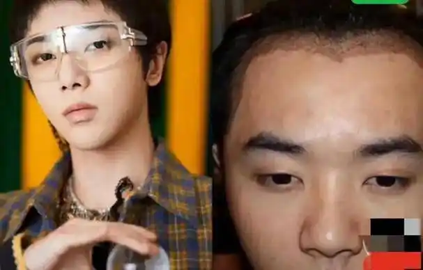 知情人士爆料华晨宇整容前照片,太恐怖了,他这些年究竟变了多少_外貌