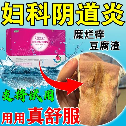 妇科炎症抑菌凝胶霉菌性治疗阴道炎宫颈糜烂的药医用壳聚糖凝胶